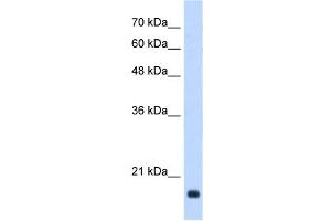 GADD45B antibody used at 0. (GADD45B Antikörper  (Middle Region))