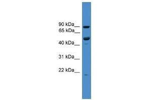 Western Blot showing C3orf59 antibody used at a concentration of 1-2 ug/ml to detect its target protein. (MB21D2 Antikörper  (C-Term))