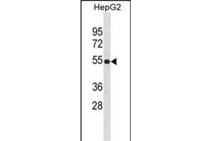ZNF101 anticorps  (AA 122-148)