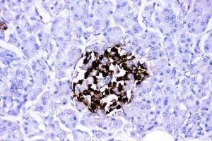 IHC analysis of VIP using anti-VIP antibody (ABIN4886760). (Vip Antikörper  (Middle Region))