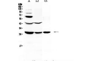 Western blot analysis of TL1A using anti-TL1A antibody . (TNFSF15 Antikörper  (AA 72-244))