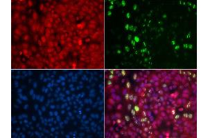 Immunofluorescence analysis of U2OS cells using Phospho-ABL1-Y204 antibody (ABIN5969866). (ABL1 Antikörper  (pTyr204))