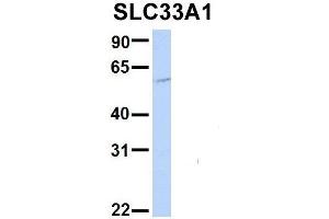 Host:  Rabbit  Target Name:  EGFL8  Sample Type:  Hela  Antibody Dilution:  1. (SLC33A1 Antikörper  (Middle Region))
