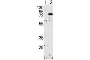 Western blot analysis of PKC beta antibody and 293 cell lysate either nontransfected (Lane 1) or transiently transfected with the PRKCB gene (2).