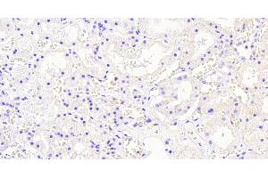 Immunohistochemistry (IHC) image for anti-Aldo-Keto Reductase Family 1, Member A1 (Aldehyde Reductase) (AKR1A1) (C-Term) antibody (ABIN184795)