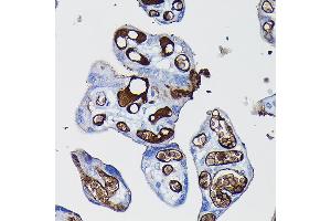 Immunohistochemistry of paraffin-embedded human placenta using Fibrinogen alpha chain (Fibrinogen alpha chain (FGA)) Rabbit pAb (ABIN7267178) at dilution of 1:100 (40x lens). (FGA Antikörper  (AA 1-100))