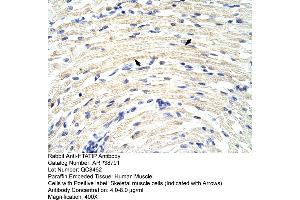 Human Muscle (KAT5 Antikörper  (N-Term))