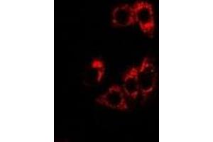 Immunofluorescent analysis of SHP staining in U2OS cells. (NR0B2 Antikörper)