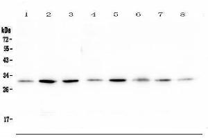 Western blot analysis of RPS3 using anti-RPS3 antibody (ABIN6719371). (RPS3 Antikörper)