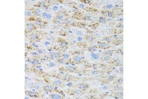 Immunohistochemistry of paraffin-embedded mouse liver using TIRAP antibody. (TIRAP Antikörper  (AA 1-221))