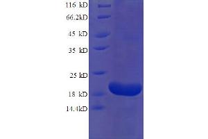 SDS-PAGE (SDS) image for Ribonuclease, RNase A Family, 2 (Liver, Eosinophil-Derived Neurotoxin) (RNASE2) (AA 28-161) protein (His tag) (ABIN5710262) (RNASE2 Protein (AA 28-161) (His tag))