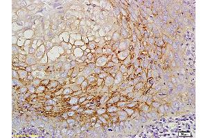 Formalin-fixed and paraffin embedded mouse intestine labeled with Anti CD44v5 Polyclonal Antibody, Unconjugated (ABIN680623) at 1:200 followed by conjugation to the secondary antibody and DAB staining (CD44RC (AA 61-139) Antikörper)