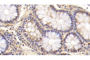 Immunohistochemistry (IHC) image for anti-CD3 epsilon (CD3E) (AA 28-185) antibody (ABIN7439360)
