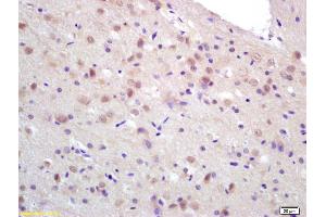 Formalin-fixed and paraffin embedded rat brain labeled with Rabbit Anti CCDC12 Polyclonal Antibody, Unconjugated (ABIN872486) at 1:200 followed by conjugation to the secondary antibody and DAB staining