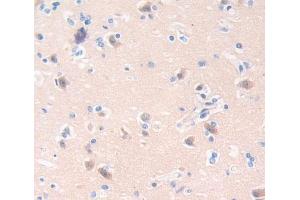 Used in DAB staining on fromalin fixed paraffin- embedded Kidney tissue (CA8 Antikörper  (AA 1-290))