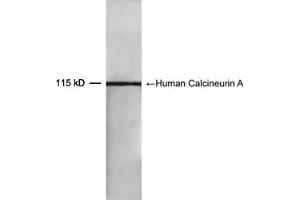 Western blot analysis of recombinant human Calcineurin A protein using 0. (Calcineurin A Antikörper  (AA 450-500))