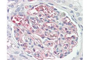 Image no. 1 for anti-C4b-Binding Protein antibody (ABIN957838) (C4BP Antikörper)