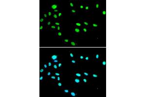 Immunofluorescence analysis of A549 cells using RUVBL1 antibody. (RUVBL1 Antikörper)