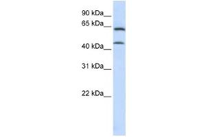 Western Blotting (WB) image for anti-Chondroitin Sulfate N-Acetylgalactosaminyltransferase 1 (CSGALNACT1) antibody (ABIN2459114) (CSGALNACT1 Antikörper)