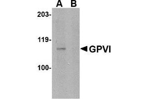 Western Blotting (WB) image for anti-Glycoprotein VI (Platelet) (GP6) (Middle Region) antibody (ABIN1030943) (GP6 Antikörper  (Middle Region))