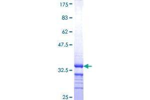 Claudin 18 Protein (CLDN18) (AA 196-261) (GST tag)