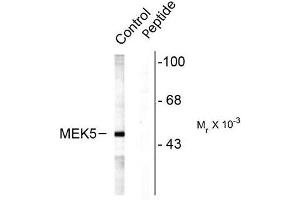 Image no. 1 for anti-Mitogen-Activated Protein Kinase Kinase 5 (MAP2K5) (pSer311), (pThr315) antibody (ABIN372667)