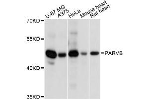 Western blot analysis of extracts of various cell lines, using PARVB antibody. (Parvin, beta Antikörper)