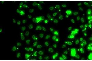 Immunofluorescence analysis of HeLa cells using SECISBP2 Polyclonal Antibody