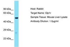 Image no. 1 for anti-Glucagon-Like Peptide 1 Receptor (GLP1R) (AA 101-150) antibody (ABIN6750508) (GLP1R Antikörper  (AA 101-150))