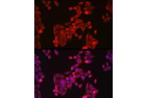 Immunofluorescence analysis of HeLa cells using ZIP14 Rabbit pAb (ABIN6133191, ABIN6147993, ABIN6147994 and ABIN6214658) at dilution of 1:100 (40x lens). (SLC39A14 Antikörper  (AA 240-340))