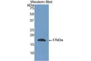 Western blot analysis of the recombinant protein. (CD40 Ligand Antikörper  (AA 180-261))