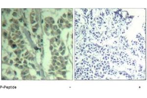 Image no. 2 for anti-Cas-Br-M (Murine) Ecotropic Retroviral Transforming Sequence (CBL) (pTyr700) antibody (ABIN319293) (CBL Antikörper  (pTyr700))