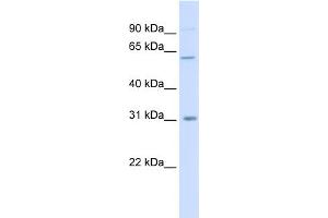 WB Suggested Anti-CHST2 Antibody Titration:  0. (CHST2 Antikörper  (Middle Region))