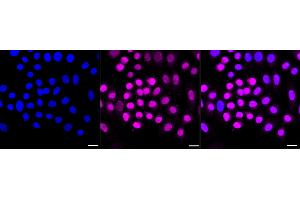 Immunocytochemical staining of HepG2 cells with Cyclin dependent kinase 1 antibody (ABIN7798207), 1:1,000). (Rekombinanter CDK1 Antikörper)