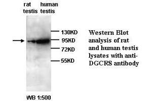 Image no. 1 for anti-DiGeorge Syndrome Critical Region Gene 8 (DGCR8) antibody (ABIN790956) (DGCR8 Antikörper)