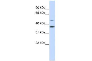 WB Suggested Anti-C2orf25 Antibody Titration: 0. (MMADHC Antikörper  (Middle Region))