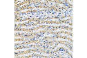 Immunohistochemistry of paraffin-embedded mouse kidney using C4BPB antibody at dilution of 1:100 (40x lens). (C4BPB Antikörper)