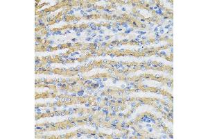 Immunohistochemistry of paraffin-embedded mouse kidney using C4BPB antibody at dilution of 1:100 (40x lens). (C4BPB Antikörper)