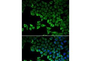 Immunofluorescence analysis of HeLa cells using RIG-I / DDX58 Polyclonal Antibody (DDX58 Antikörper)