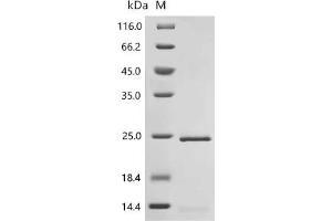 (Tris-Glycine gel) Discontinuous SDS-PAGE (reduced) with 5 % enrichment gel and 15 % separation gel.