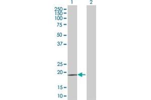 Lane 1: CD53 transfected lysate ( 24. (CD53 293T Cell Transient Overexpression Lysate(Denatured))
