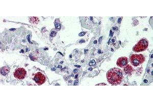 IHC Information:  Lung, Human: Formalin-Fixed, Paraffin-Embedded (FFPE) (CYBB Antikörper  (C-Term))