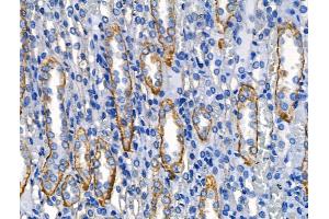 ABIN6262627 and ABIN6268688 at 1/100 staining Rat kidney tissue by IHC-P. (IL-4 Antikörper  (Internal Region))