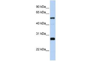 Western Blotting (WB) image for anti-Family with Sequence Similarity 83, Member F (FAM83F) antibody (ABIN2459545) (FAM83F Antikörper)