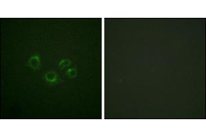 Immunofluorescence analysis of A549 cells, using EPHA2/3/4 (Ab-588/596) antibody. (EPHA2/3/4 Antikörper)