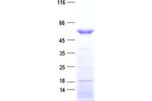 Western Blotting (WB) image for HORMA Domain Containing 1 (HORMAD1) protein (His tag) (ABIN2722966)