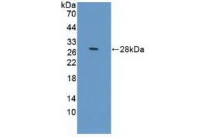 Figure. (Prolactin Receptor Antikörper  (AA 25-234))