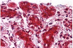 Human Breast: Formalin-Fixed, Paraffin-Embedded (FFPE) (CLIC1 Antikörper  (AA 1-242))