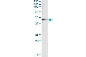 Immunoprecipitation (IP) image for anti-Histone Deacetylase 8 (HDAC8) (AA 1-101) antibody (ABIN961393) (HDAC8 Antikörper  (AA 1-101))