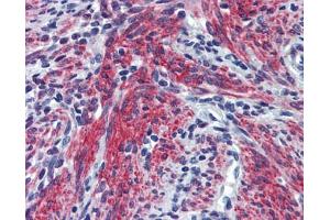 POSTN antibody was used for immunohistochemistry at a concentration of 4-8 ug/ml. (Periostin Antikörper  (N-Term))